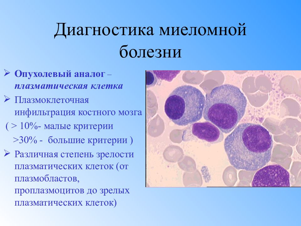 Презентация на тему миеломная болезнь