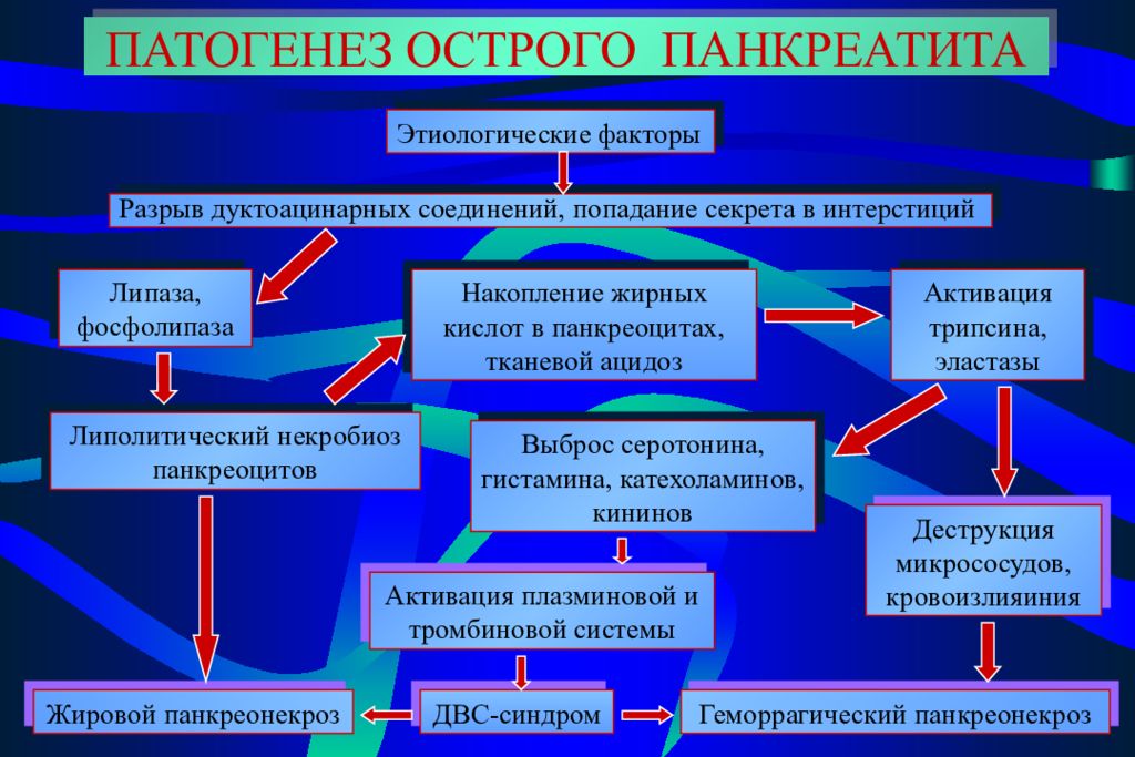 Патогенез острого панкреатита схема