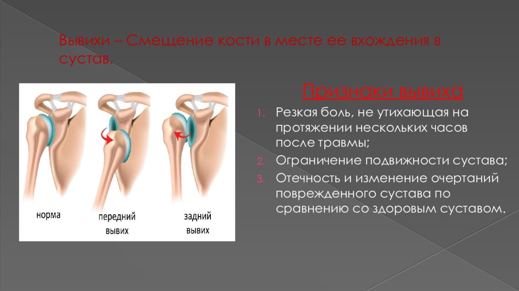 Смещение костей в суставе. Смещение кости признаки.