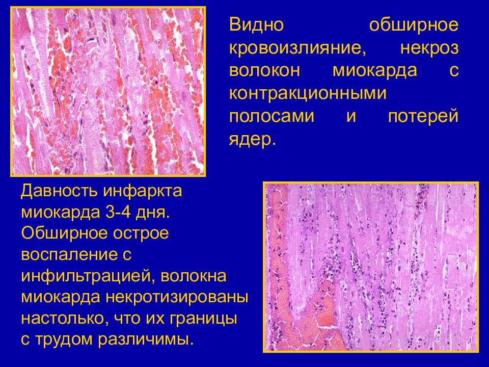 Сосудистая патология