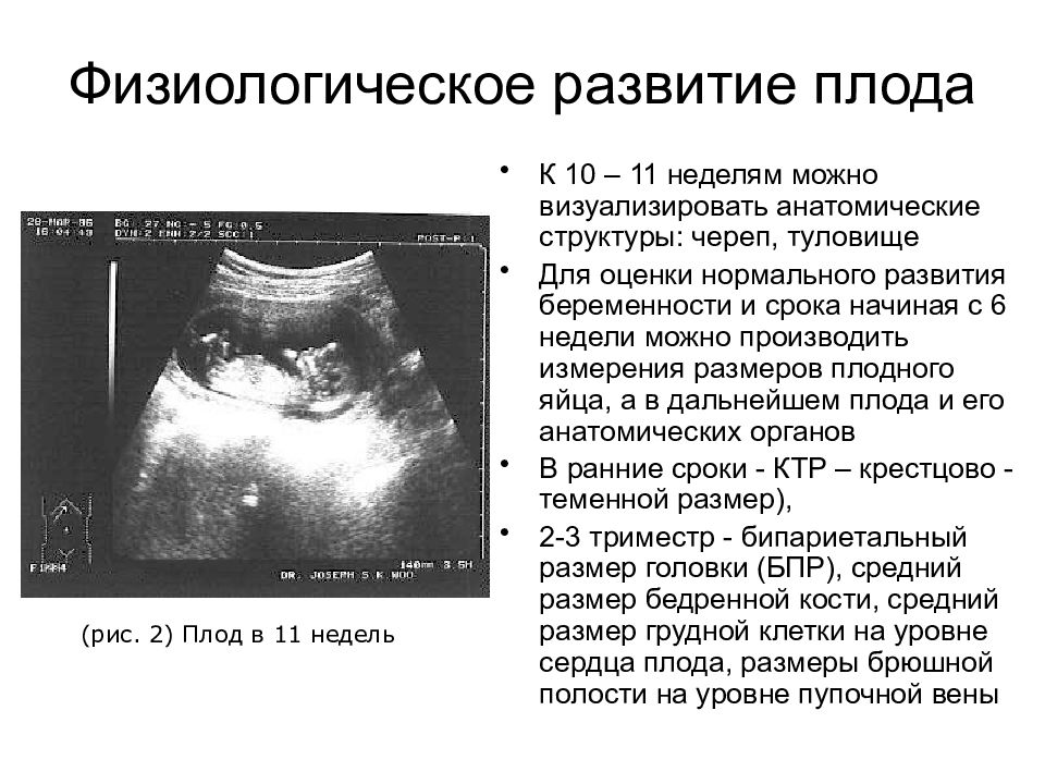 Беременность 10 недель развитие плода фото размеры