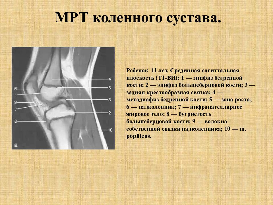 Мрт Коленного Сустава Ростов На Дону Цена