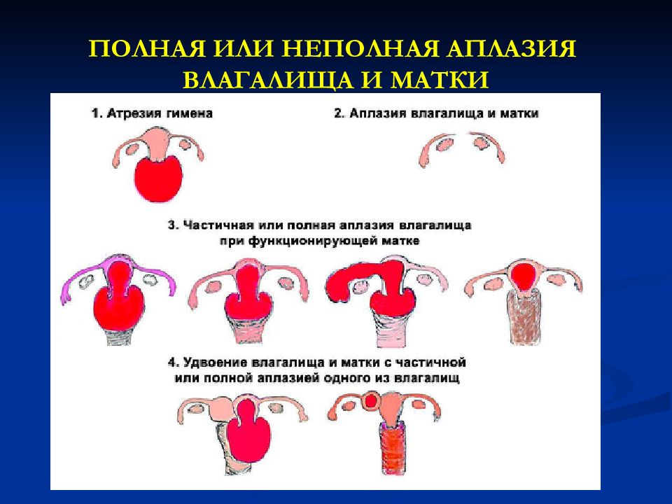 Аномалия развития и положения женских органов презентация