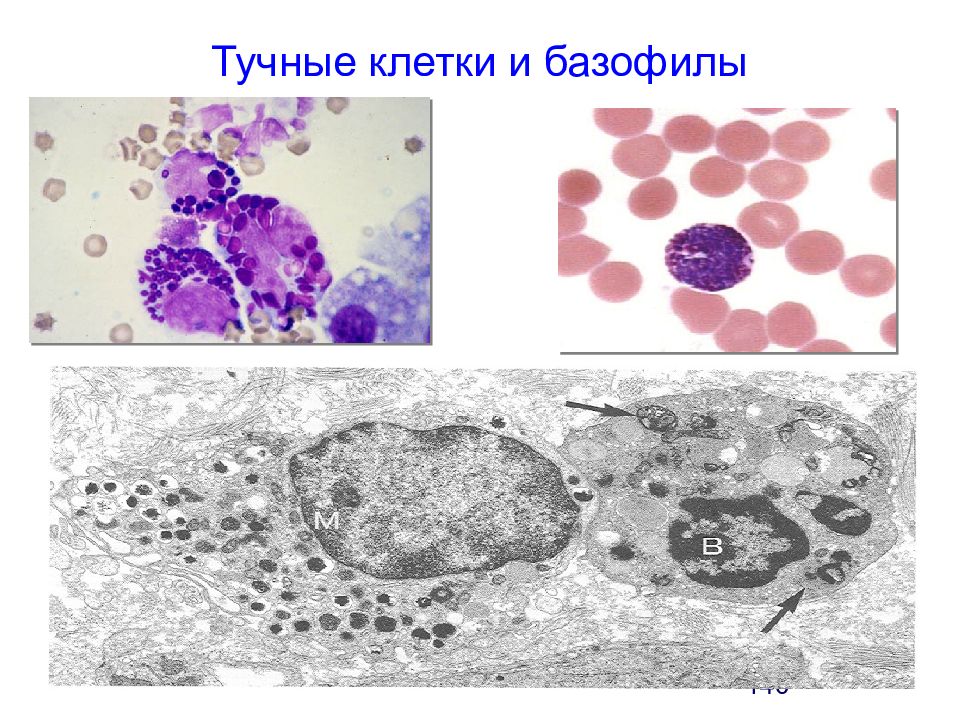 Тканевые базофилы. Тучные клетки гистология. Тучные клетки гистамин. Тучные клетки (тканевые базофилы). Тучные клетки гистология препарат.