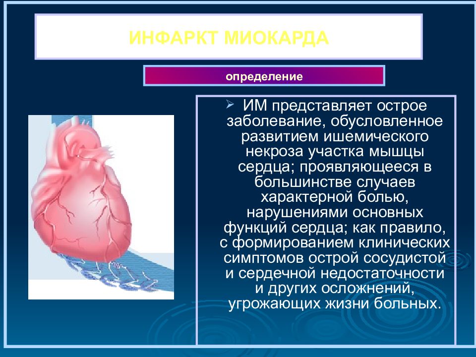 Инфаркт симптомы и последствия. ИБС острый инфаркт миокарда. Инфаркт миокарда определение. Острый инфаркт миокарда определение.