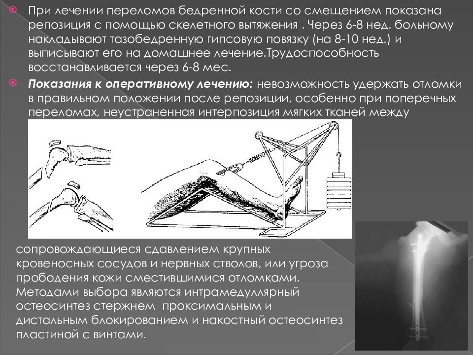 Презентации на тему переломы