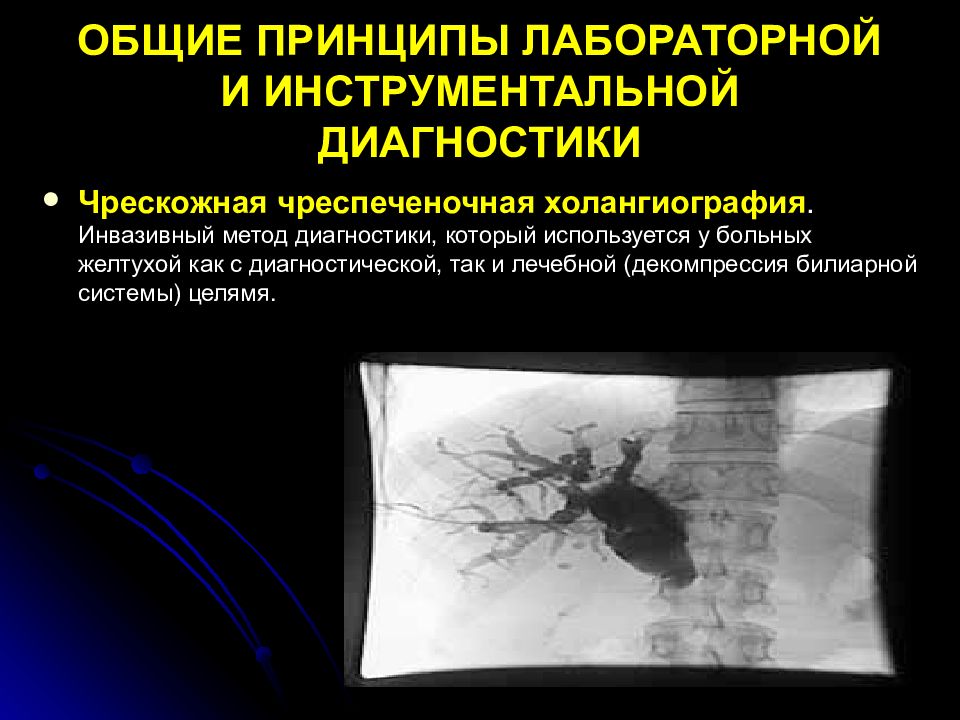 Холангиография. Чрескожная чреспеченочная холангиопанкреатография. Чрескожно чреспеченочная холангиография. Антеградная холангиография. Чрескожная холангиография метод.