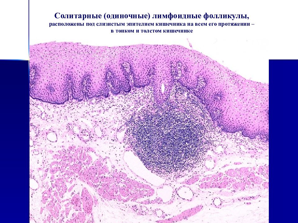 Лимфоидная ткань стенок органов пищеварения