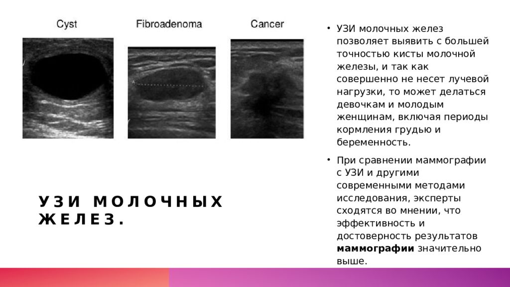 Что информативнее узи или маммография молочной железы