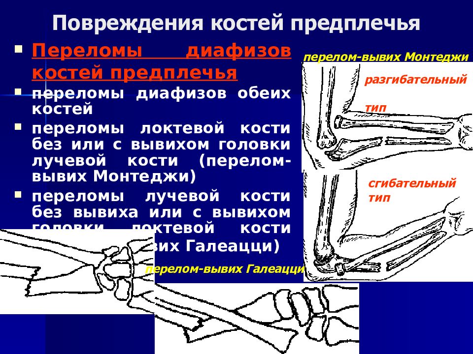 Перелом предплечья картинки