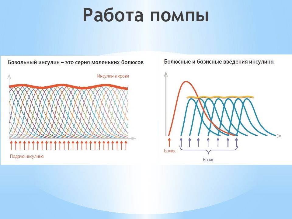 Помповая инсулинотерапия презентация