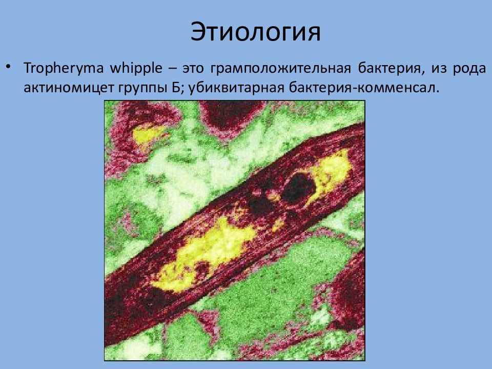 Болезнь уиппла картинки