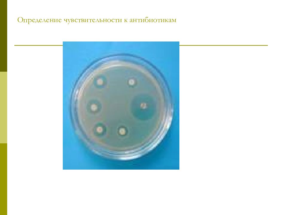 Определение чувствительности к антибиотикам. Чувствительность к антибиотикам. Чувствительность к антибиотикам определяют. Opredelenie chustvitelnosti k antibiotikam.