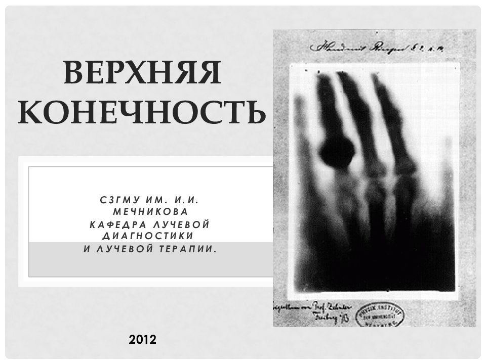 Верхняя конечность