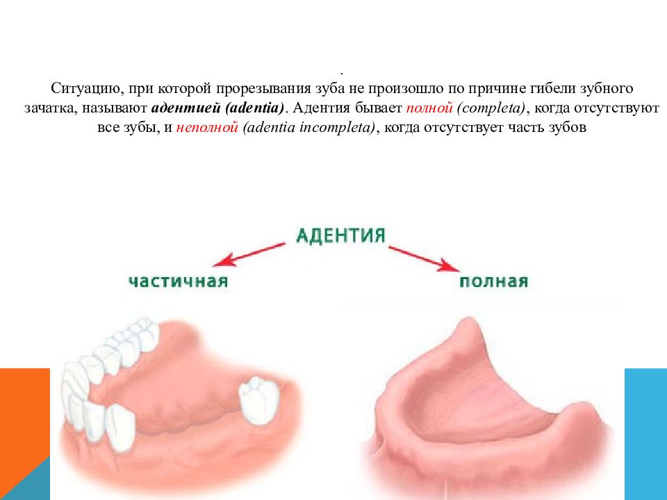 Болезни прорезывания зубов презентация