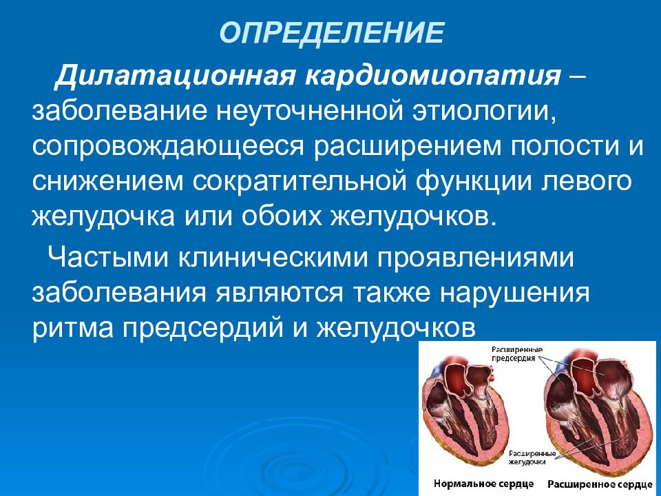 Кардиомиопатия сердца что это. Заболевания сердца кардиомиопатии. Дилатационная и рестриктивная кардиомиопатия. Кардиомиопатия:гипертрофическая,дилатационная,рестриктивная.. Дилатационная кардиомиопатия сопутствующие заболевания.