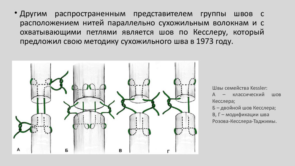 Презентация операции на сухожилиях