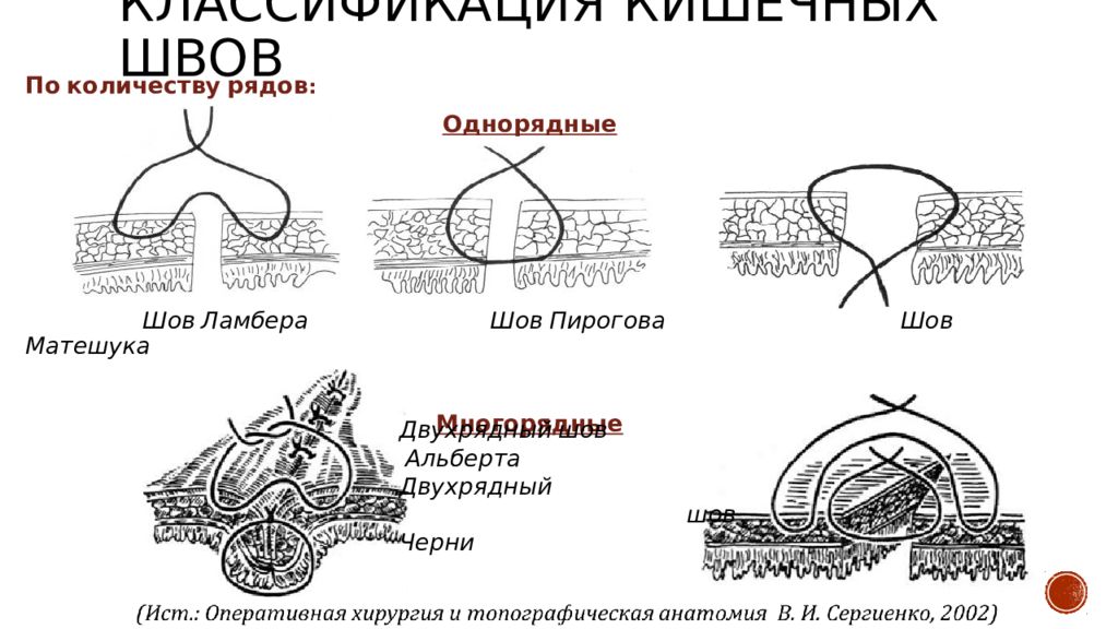 Швы в хирургии презентация