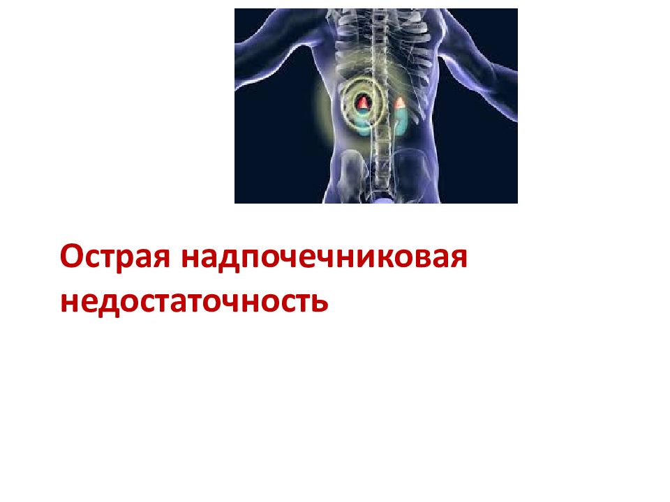 Шоковые органы. Джон Кеннеди надпочечниковая недостаточность. Надпочечниковая недостаточность фото. Надпочечниковый криз картинка. Истмикоцервикальная недостаточность картинка для презентации \.