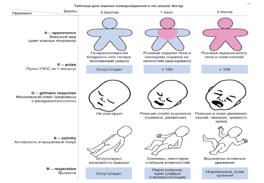 Степени асфиксии новорожденных по шкале апгар