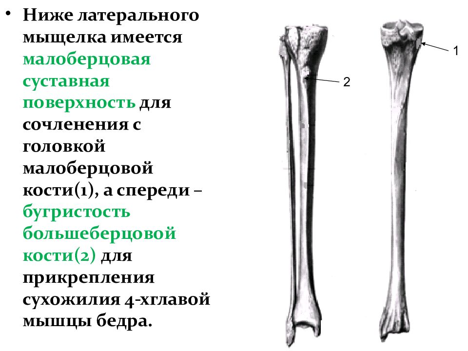 Правая малоберцовая кость. Головка большеберцовая кость анатомия. Суставная поверхность большеберцовой кости. Малоберцовая кость рентген анатомия. Дистальный метафиз малоберцовой кости.