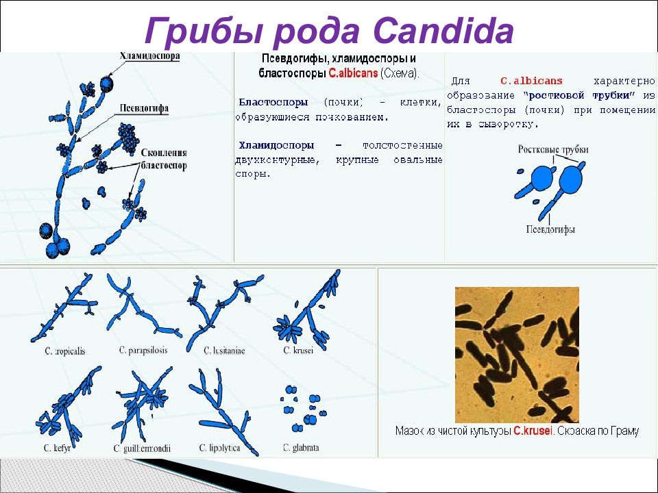 Грибы кандида. Грибок рода кандида Граму. Грибы рода кандида окраска по Граму. Окраска по Граму грибов кандида. Дрожжеподобные грибы рода кандида микробиология.