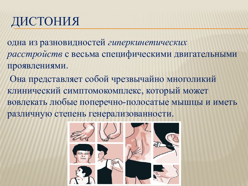 Лечение Спастической Кривошеи В Новосибирске