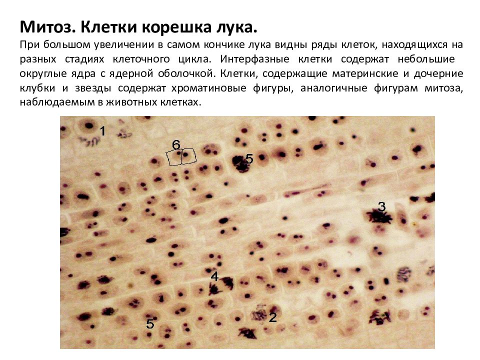 Лабораторная работа наблюдение митоза в клетках кончика. Митоз в растительных клетках корешка лука препарат. Кариокинез в корешке лука препарат. Препарат митоз в корешке лука. Микропрепарат клеток корешка лука.