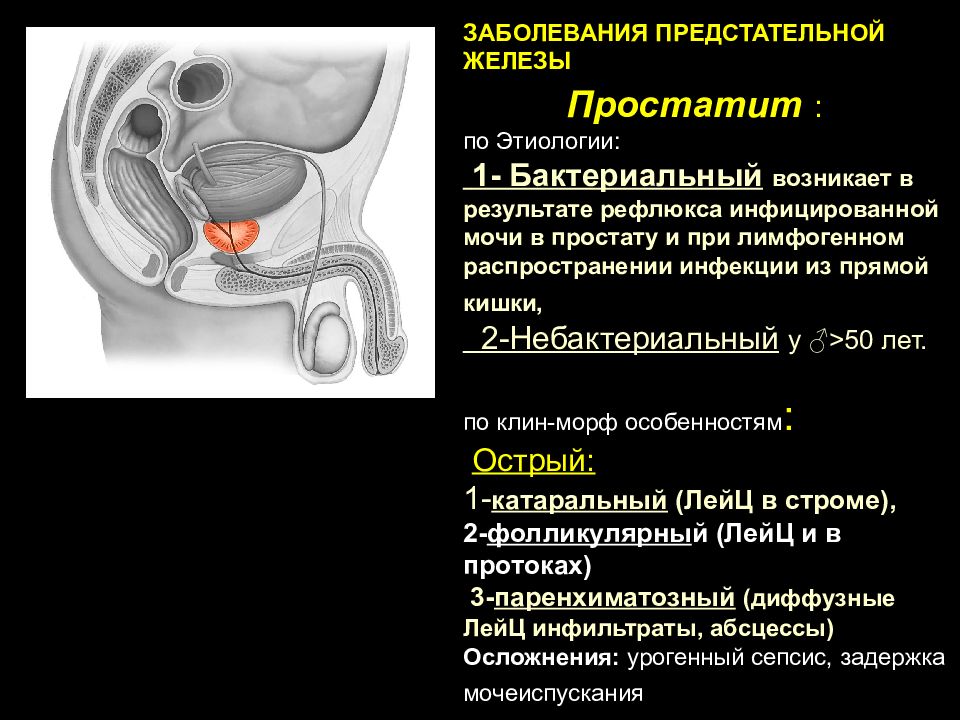 Аномалии половых органов. Заболевания половых желез. Заболевания полового члена.