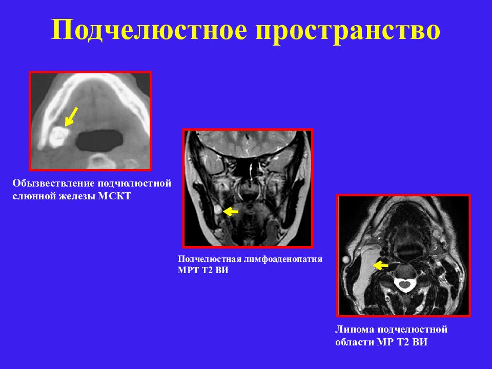 Лучевая диагностика заболеваний головы и шеи презентация