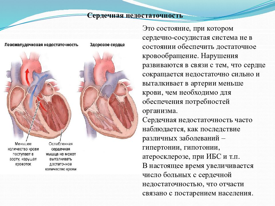 Исследовательский проект сердечно сосудистые заболевания