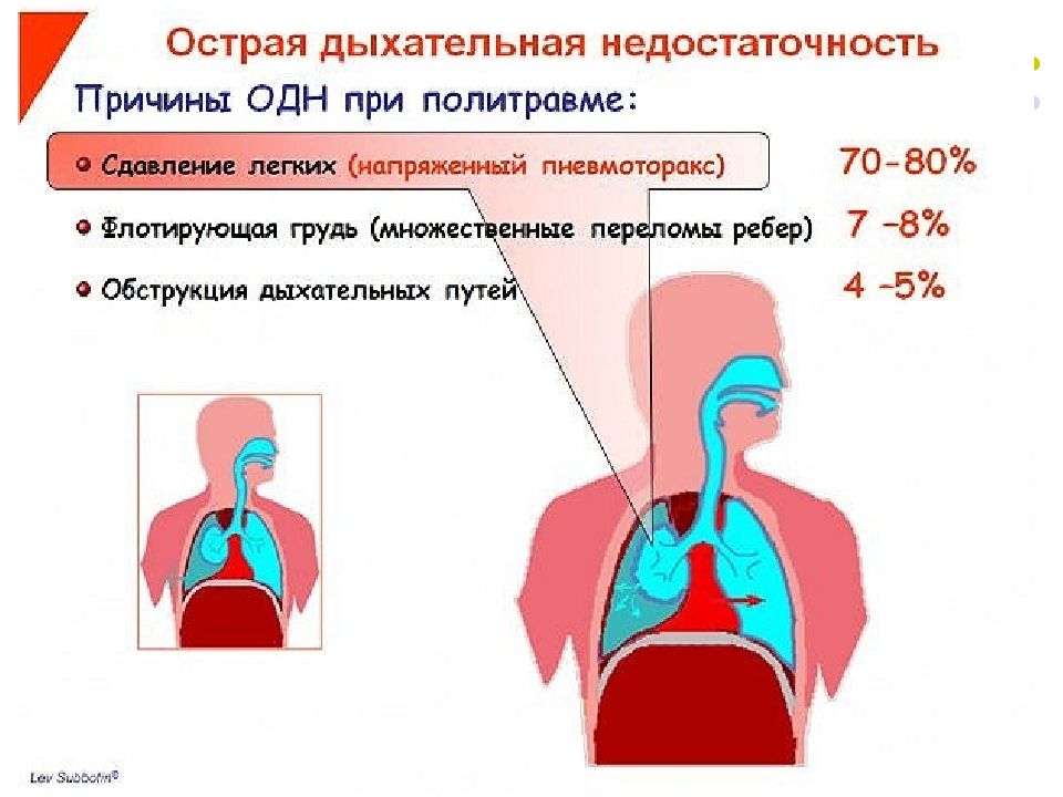 Легочная недостаточность презентация