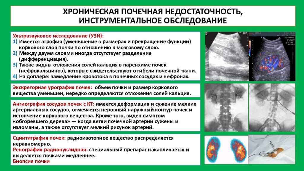 Изменения почек. Хроническая почечная недостаточность на УЗИ. Острая почечная недостаточность на УЗИ. Хроническая почечная недостаточность инструментальные исследования. УЗИ почек ХБП.