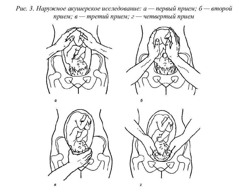 Методы обследования в акушерстве презентация