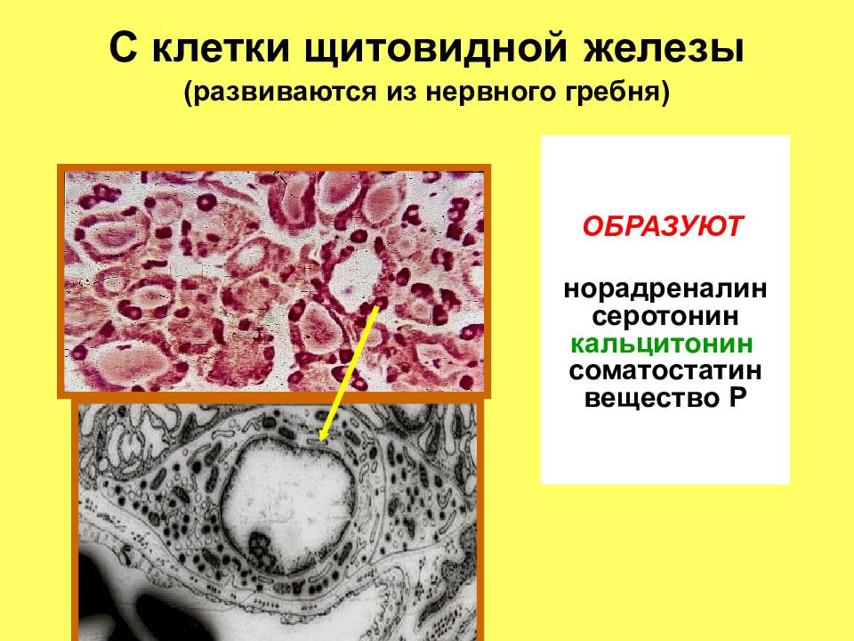 Щитовидная железа клетки. Секреторные клетки щитовидной железы. Клетки щитовидной железы гистология. Гормоны щитовидной железы гистология. Клетки щитовидной железы гистология клетки.