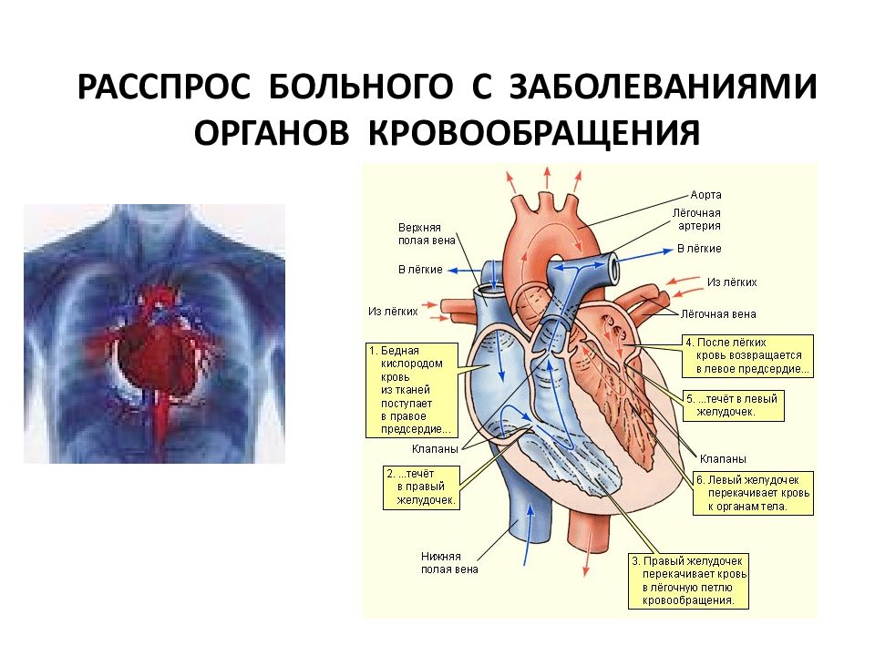 Наблюдение и уход за больными с заболеваниями органов кровообращения презентация