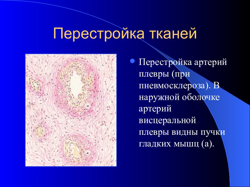 Презентация атрофия и склероз