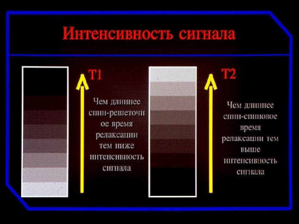 Контраст отзывы. Интенсивность сигнала при мрт. Сигналы мрт. Сигнальные характеристики в мрт. Низкая интенсивность сигнала на мрт.