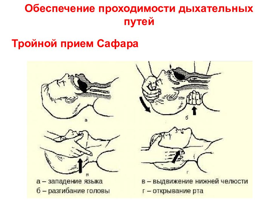 Прием сафара картинки