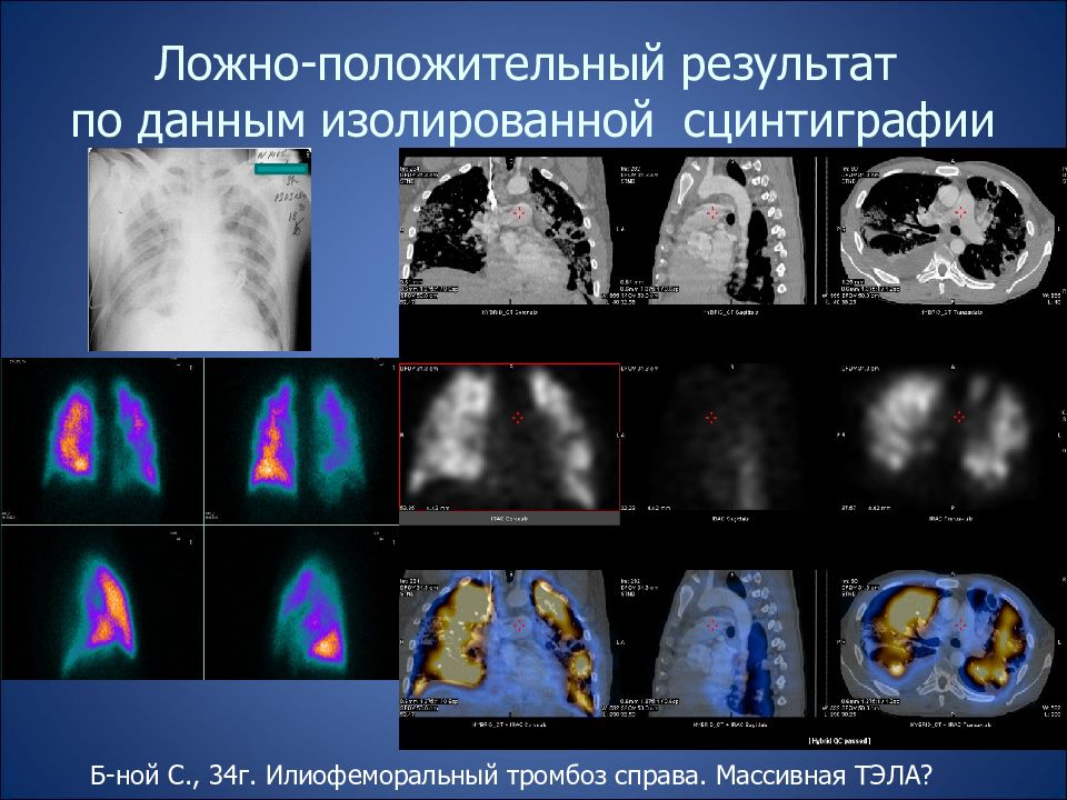 Тэла карта вызова