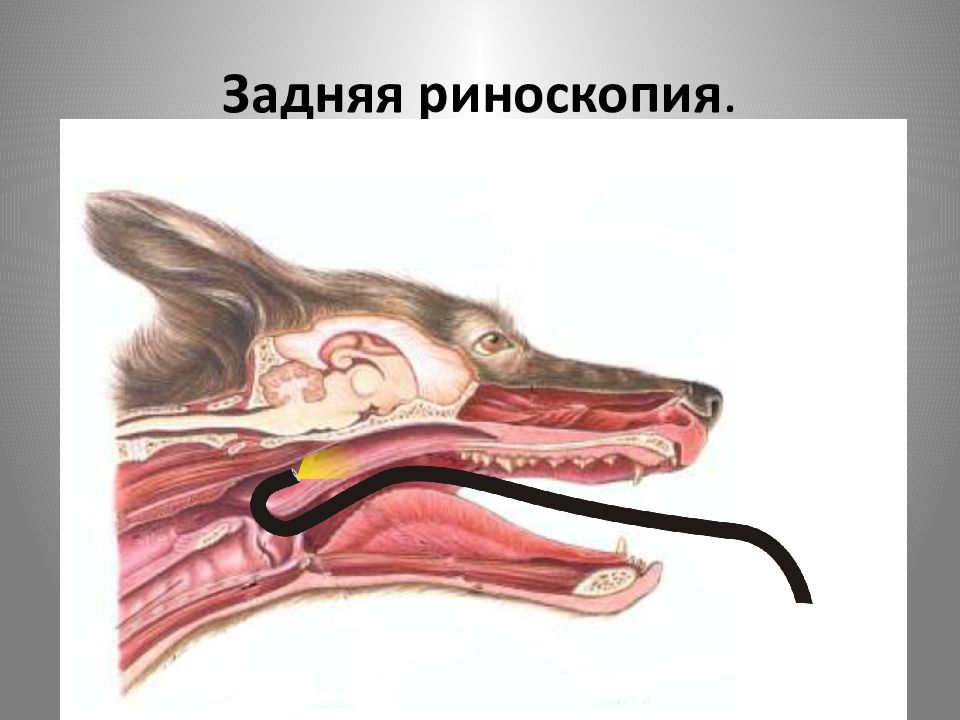 Риноскопия больно