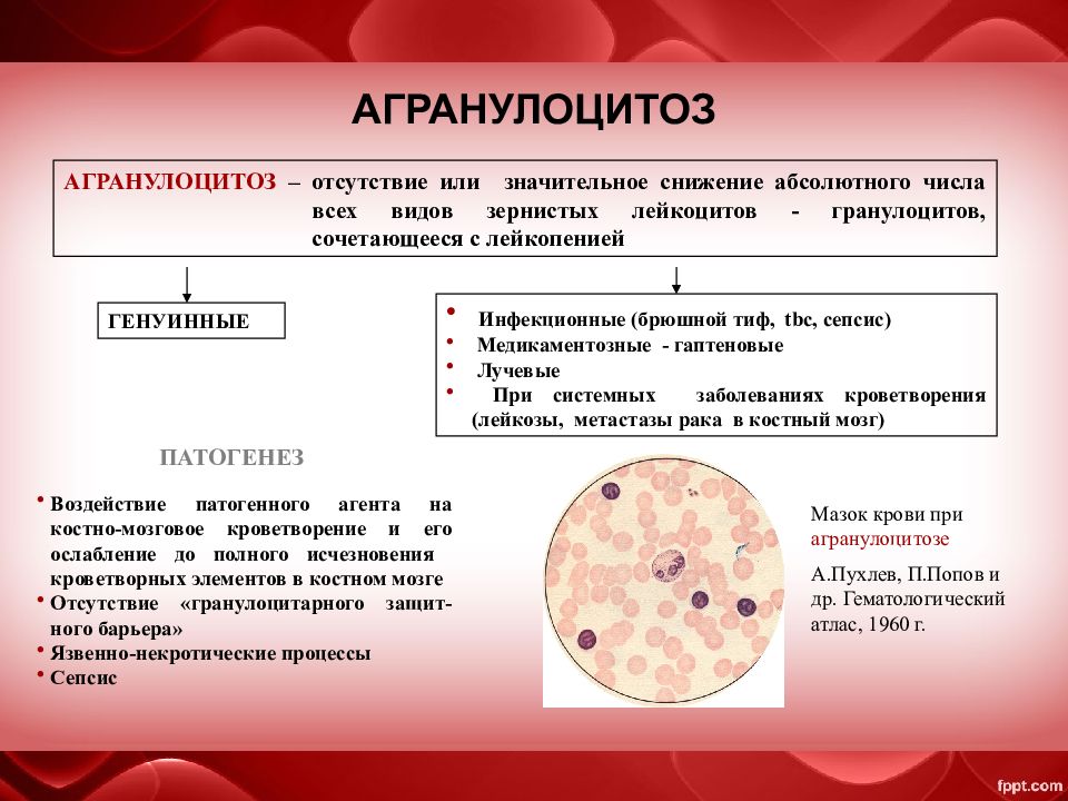 Агранулоцитоз картина крови