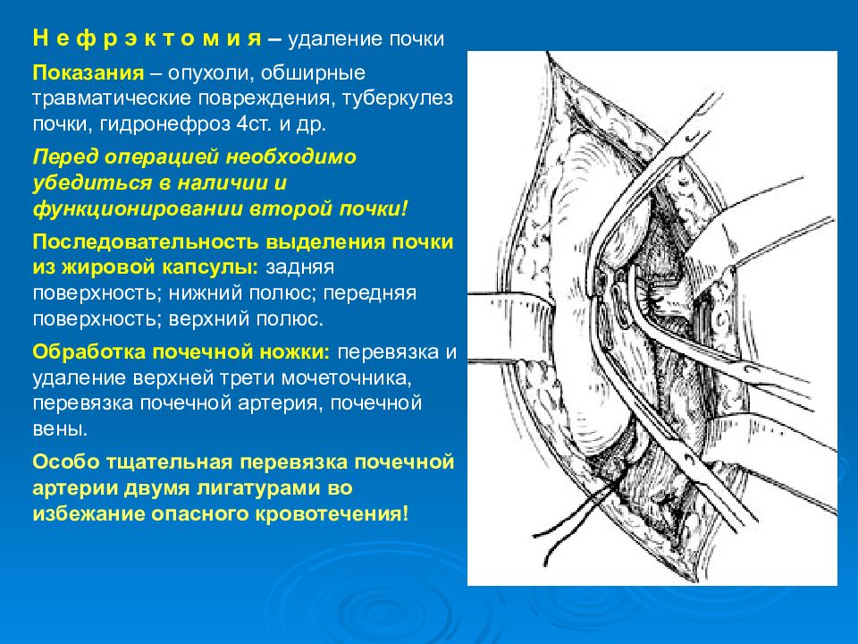 Презентация топография почек