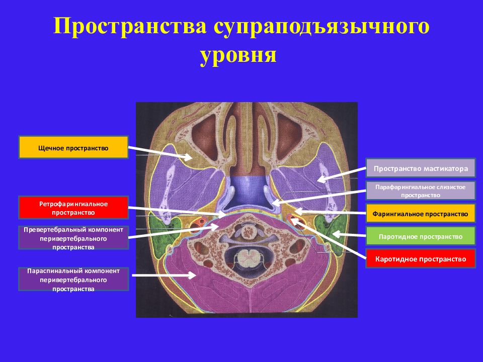 Пространство кт. Клетчаточные пространства шеи кт. Клетчаточные пространства шеи мрт. Пространства шеи кт анатомия. Каротидное пространство шеи.