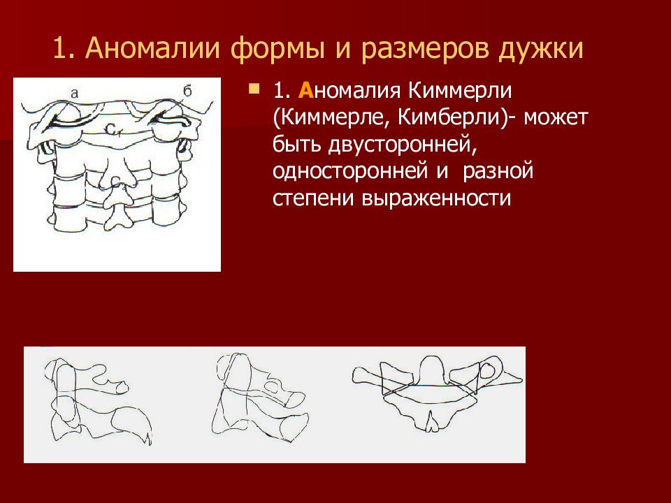 Аномалия киммерли картинка