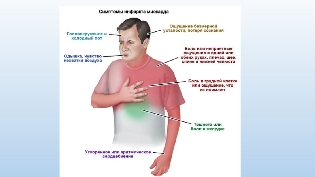 Реабилитация после инфаркта 88007754613. Реабилитация при инфаркте миокарда. Реабилитация после инфаркта презентация. Реабилитация при остром инфаркте миокарда. Цвет кожи при инфаркте миокарда.