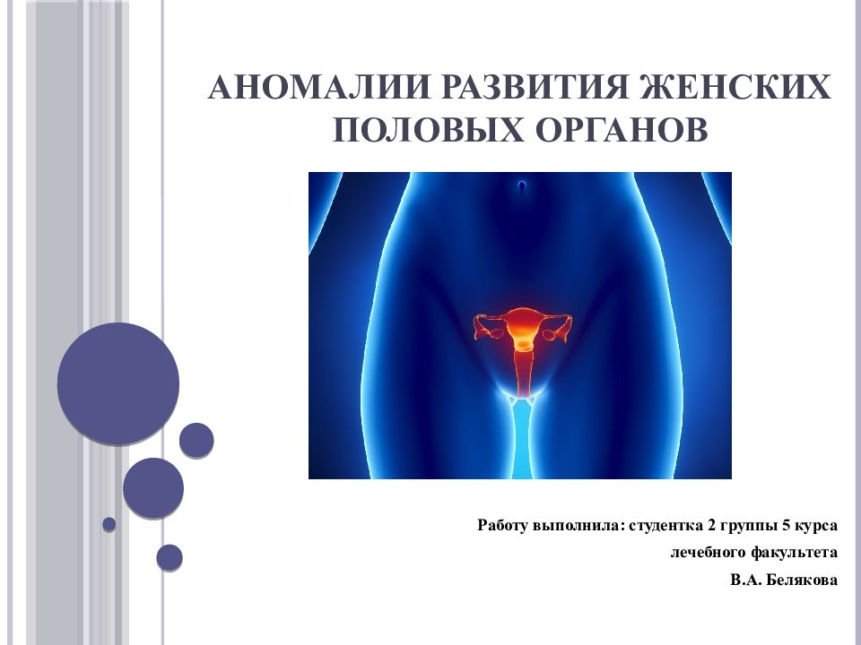 Аномалии женских половых органов презентация