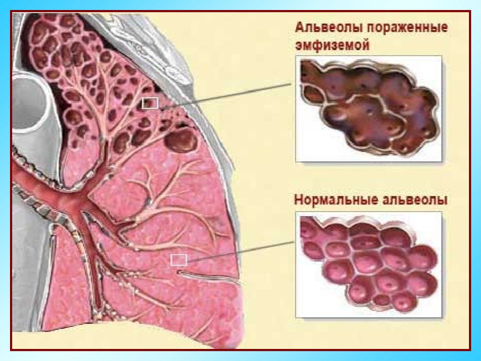 Старение дыхательной системы