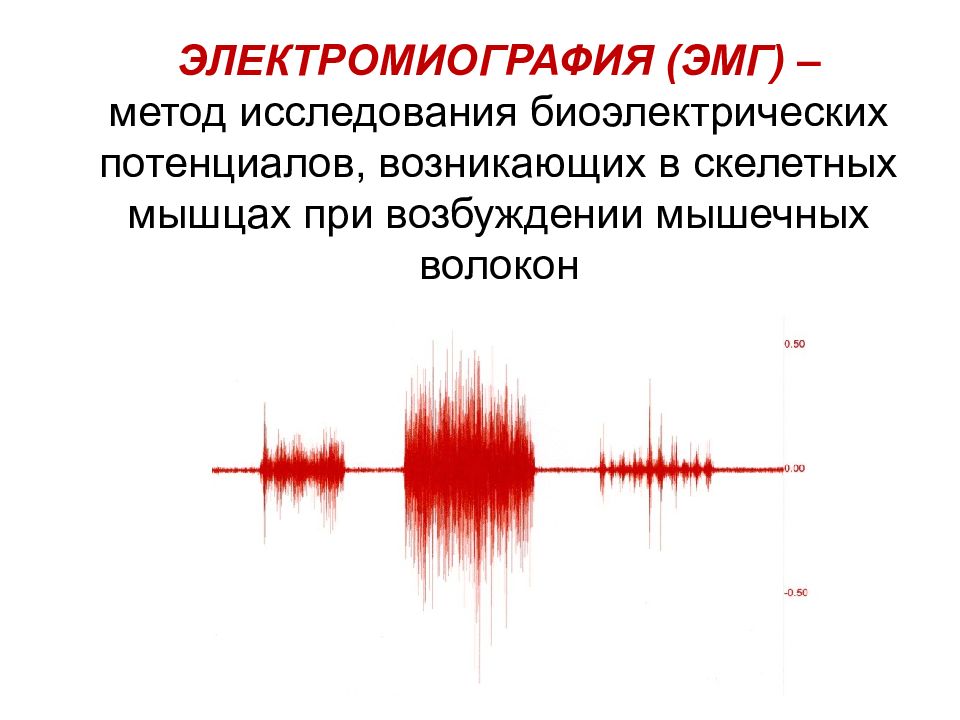 Диагностика нервов. Электромиография скелетных мышц: принцип метода, методика. Электромиография принцип метода. Метод электромиографии физиология. Электромиография метод исследования.