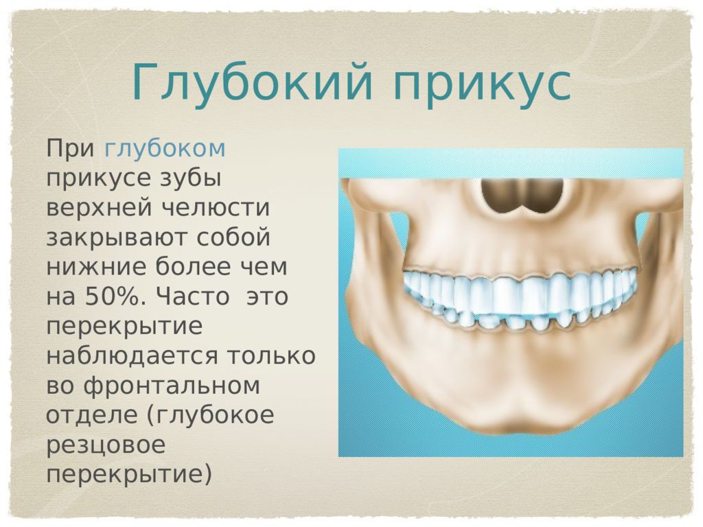 Основы окклюзионной диагностики презентация